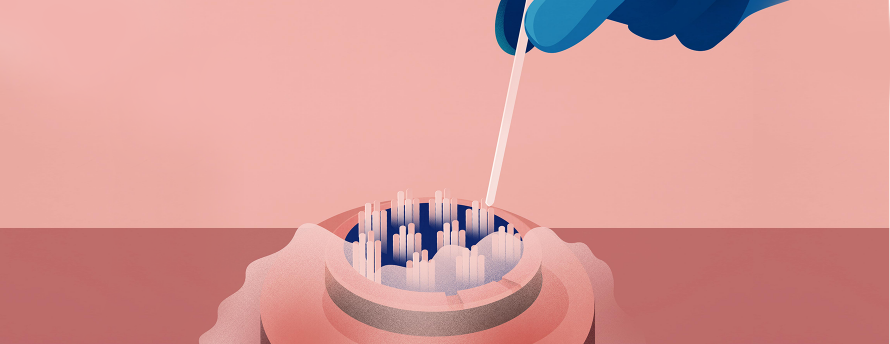 Fertility-Preservation