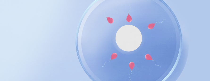 Your guide to in-vitro fertilization